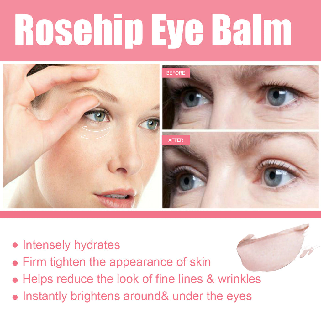 Women's Rosehip Renewing Eye Balm | Anti-Aging Eye Care